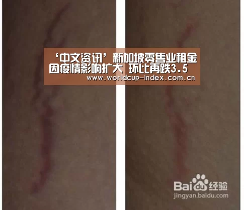 ‘中文资讯’新加坡零售业租金因疫情影响扩大 环比再跌3.5%(图2) 赛程查询